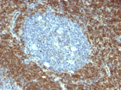 Formalin-fixed, paraffin embedded human tonsil sections stained with 100 ul anti-Bcl-2 (clone BCL2/796) at 1:100. HIER epitope retrieval prior to staining was performed in 10mM Tris 1mM EDTA, pH 9.0.